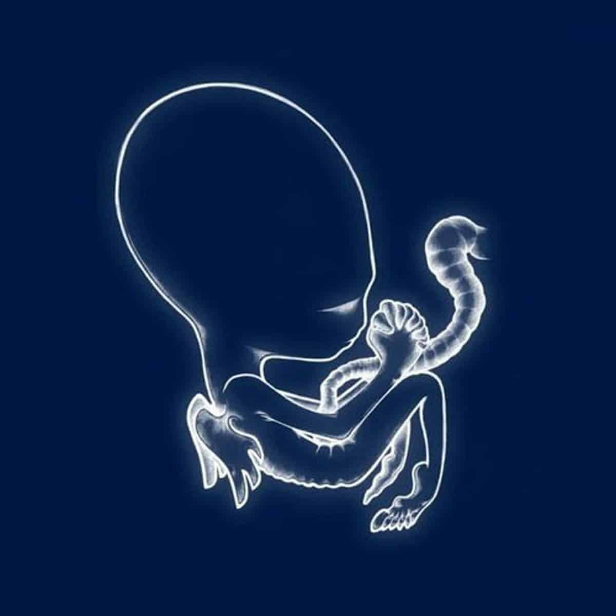 Sigur Rós – Ágætis Byrjun